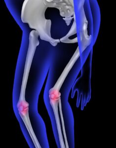 高反発敷布団が男性の腰痛に与える影響とは？